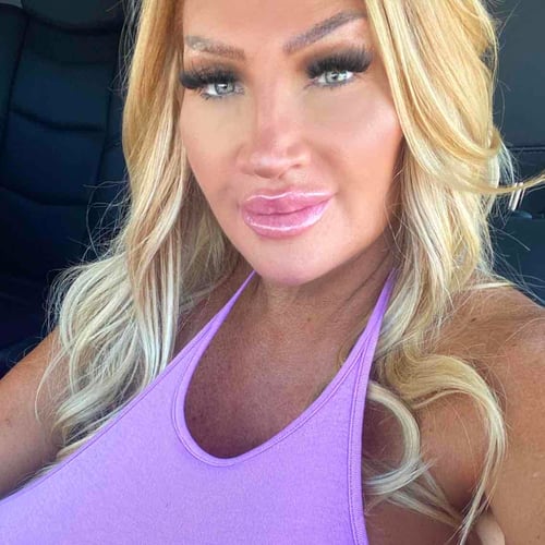 Woman Goes on 'Botched' For Self-Inflated Implants
